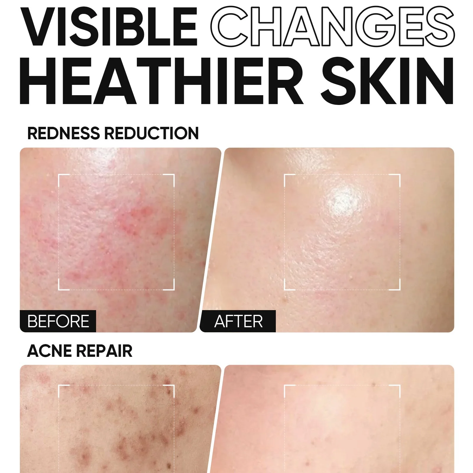 5X Ceramide Barrier Repair Moisture Gel - Image 4